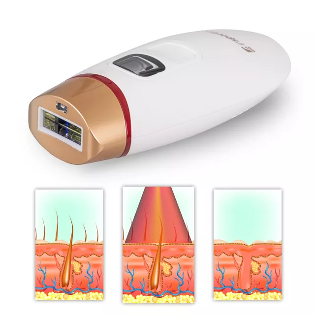 IPL epilator inSPORTline Eriva