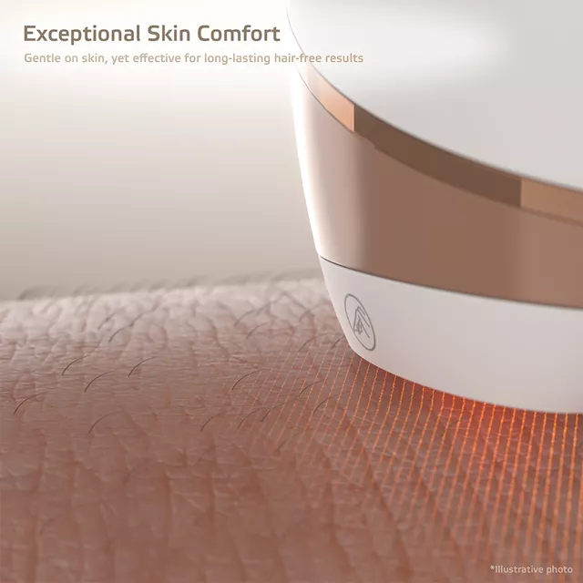 IPL epilator inSPORTline Aphira