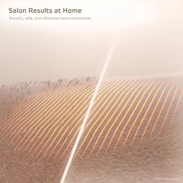 IPL epilator inSPORTline Eriva