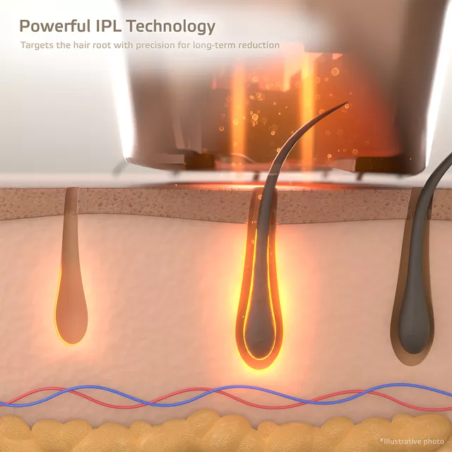 IPL epilator inSPORTline Eriva