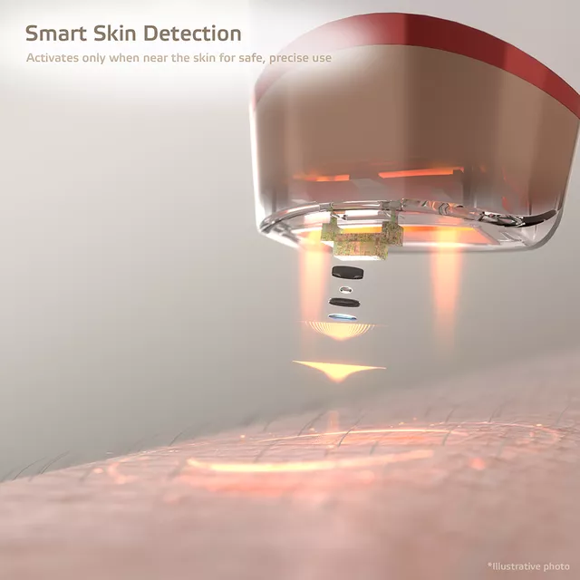 IPL epilator inSPORTline Eriva